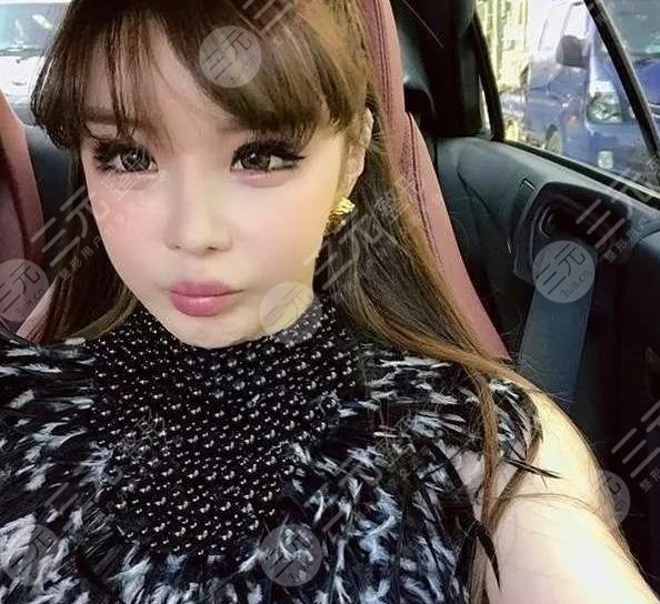 朴春变脸成“怪物”?她动了哪些地方?