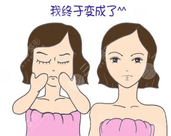 广东美恩顾浩医生下颌角磨骨后一周