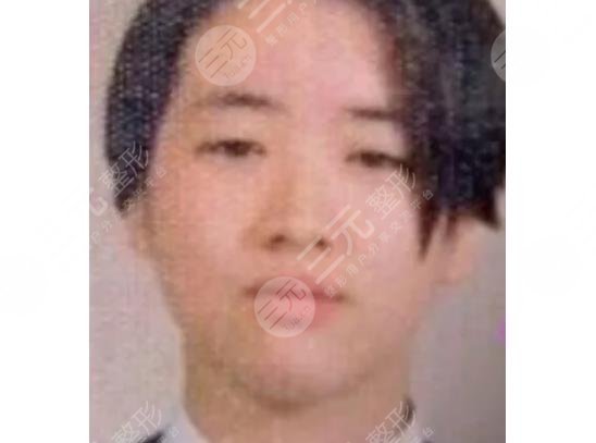 崔贞媛整容堪比换头！美貌神似李英爱！整容前竟然是这样...