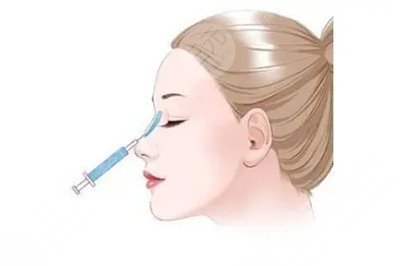 做了膨体+自体耳软骨隆鼻后 大家都说我比女神还女神