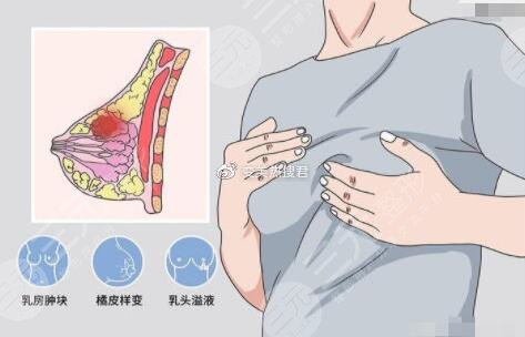 硅胶隆胸术后会出现什么样的危害?