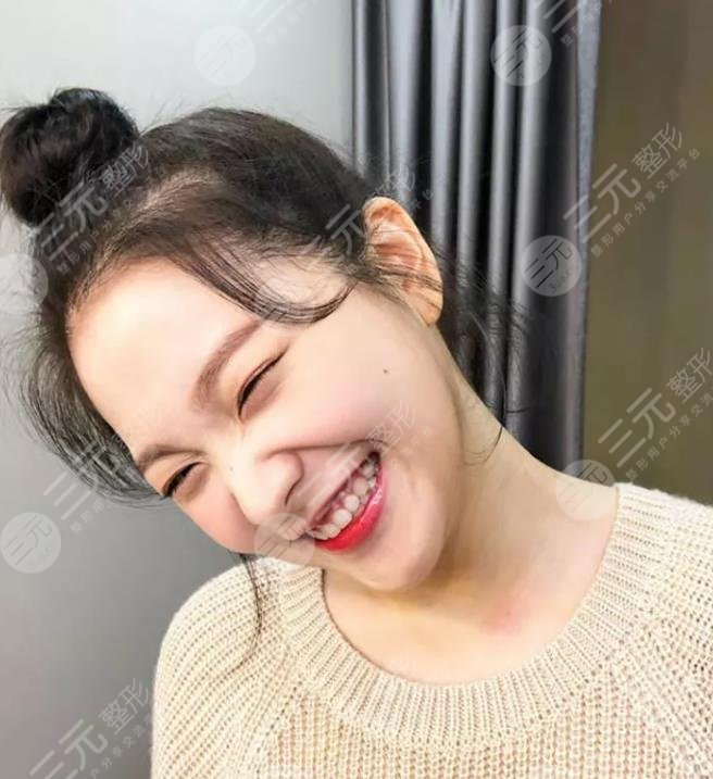 金艺琳颜值有缺陷吗?