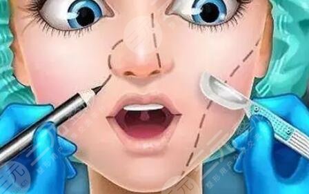 隆鼻整形前后果对比图和恢复过程