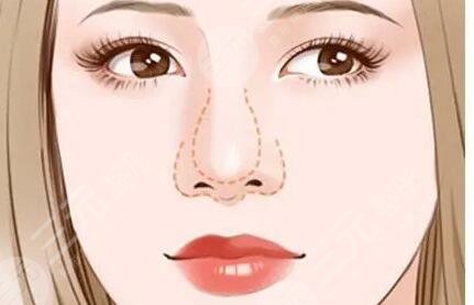 芭比眼韩式翘鼻