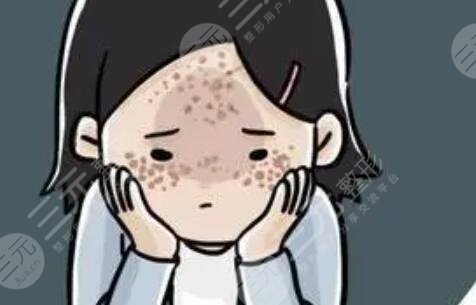 复合彩光祛斑9天 终于不是＂小麻雀＂啦