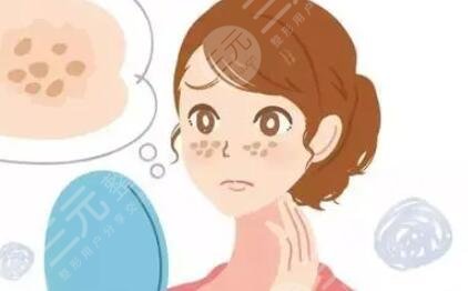 刚做复合彩光祛斑半个月 期待果越来越好