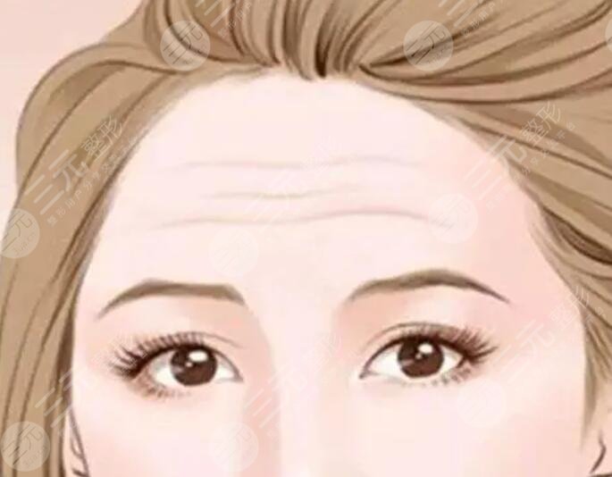 抬头纹