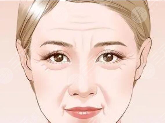 抬头纹