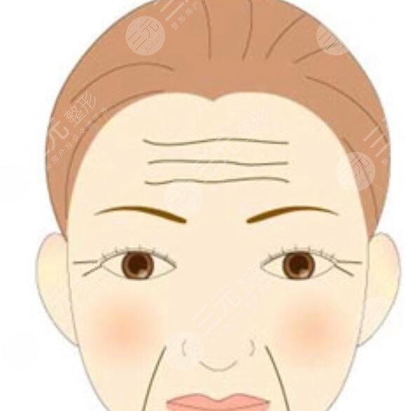 抬头纹