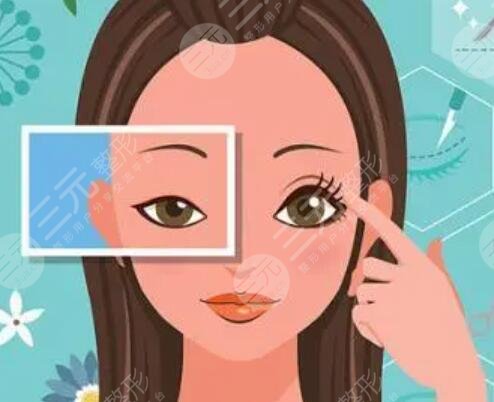 开内眼角前后对比图 开内眼角手术前后对比图