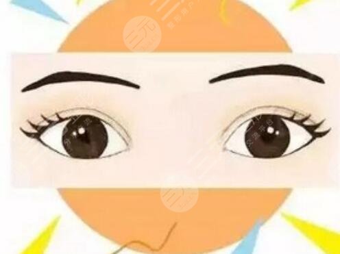 开内眼角前后对比图 开内眼角手术前后对比图
