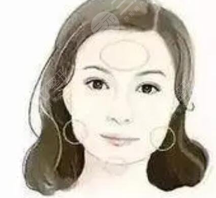 盘点娱乐圈男士下颌角整形成功案例 简直**微创