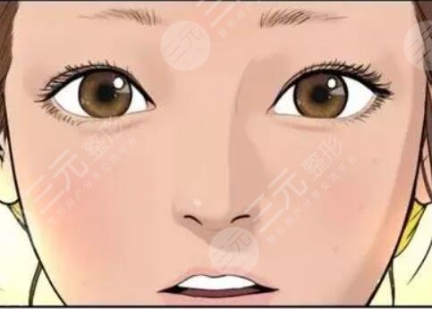 做了生物焊接双眼皮,素颜也是美美哒