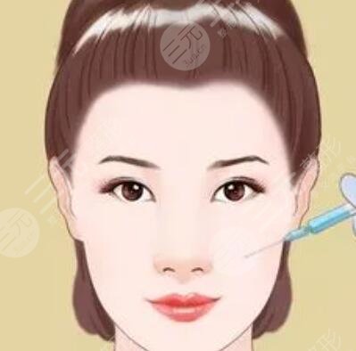 自体脂肪丰面颊 一下恢复童颜