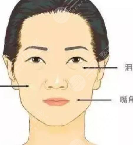 自体脂肪丰面颊 一下恢复童颜