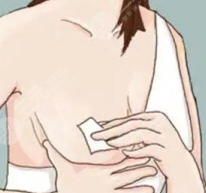 乳头缩小术 做一个更加自信的女人