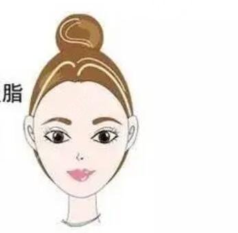 看看我的面部吸脂果图 专属于我的小V脸