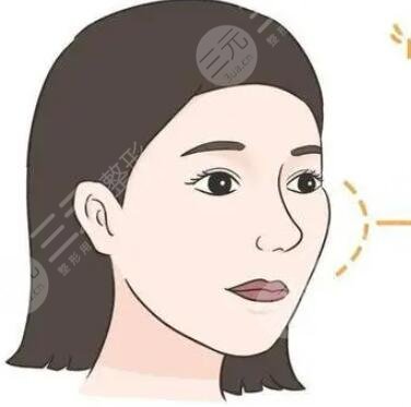 颧骨缩小术 不当“刻薄”之人