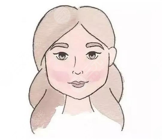 鼻尖肥大整形+自体脂肪填充苹果肌 收获一张网红脸