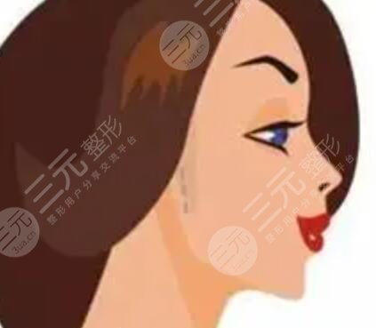 看看我的磨骨手术对比照片 从此告别苦瓜脸