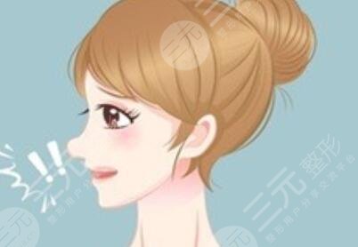 膨体隆鼻术 现在的我很自信
