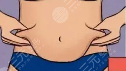 晒下我的腰腹部吸脂减肥成果 可以穿比基尼了