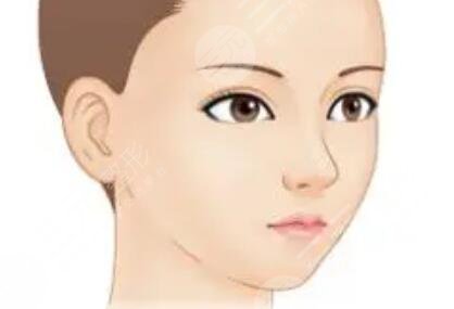 面部轮廓整形+自体脂肪填充额头 术后恢复得很自然