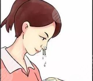 鼻尖肥大整形+鼻翼缩小前后对比 不再是“猪鼻子”