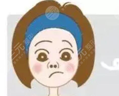 埋线法双眼皮+硅胶隆鼻手术前后对比图