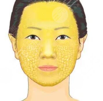 北京八大处整容医院,自体脂肪填充多少钱