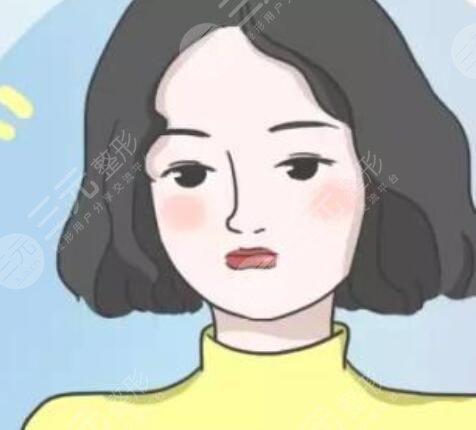 真实,案例,注射,乔雅登,玻尿酸,隆鼻,前后,对比图