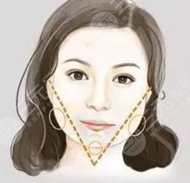下颌角整形案例