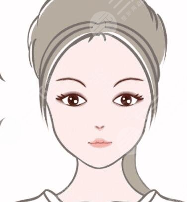 双眼皮术,消肿,妹子