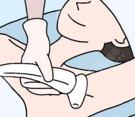 脱腋毛,过程