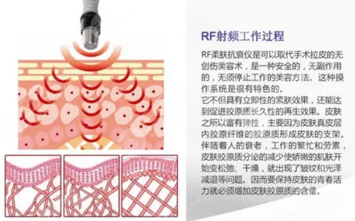 2022广州除皱整容医院名单丨紫馨中家医家庭医生美恩等介绍