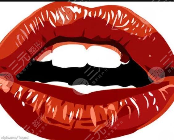 玻尿酸注射丰唇术打造嘟嘟唇前后果对比图