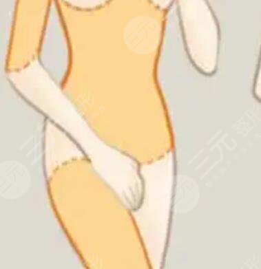 腰腹吸脂手术恢复果对比照片摆脱“游泳圈”