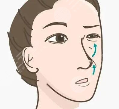 韩式生科二段隆鼻术后果图，屌丝变男神