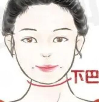 .自体脂肪面部填充果图分享 脂肪成活率更高