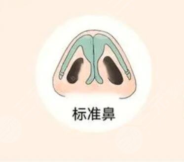 硅胶垫鼻梁+耳软骨垫鼻尖手术案例前后对比图分享