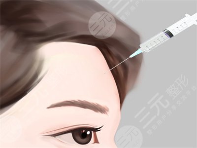 隆额头多久恢复自然？自体脂肪隆额头果对比，恢复过程分享