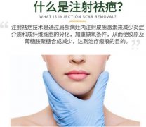 疤痕增生如何消除？疤痕软化针超全科普，正确处理修复美肌！