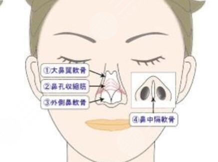 长沙南湖鼻部综合一个月对照图恢复案例|经典价目表
