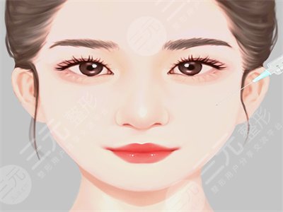 自体脂肪面部填充后四个月果图分享