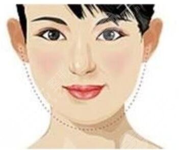 面部轮廓整形+下巴整形带来360度无死角小脸