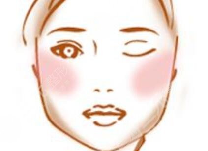 面部轮廓整形+下巴整形带来360度无死角小脸