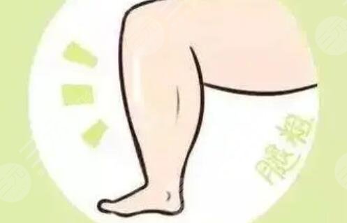 大腿吸脂术后让我重新拥有纤细美丽的双腿