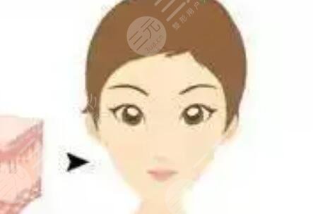 熬过哺乳期去注射注射瘦脸+去抬头纹