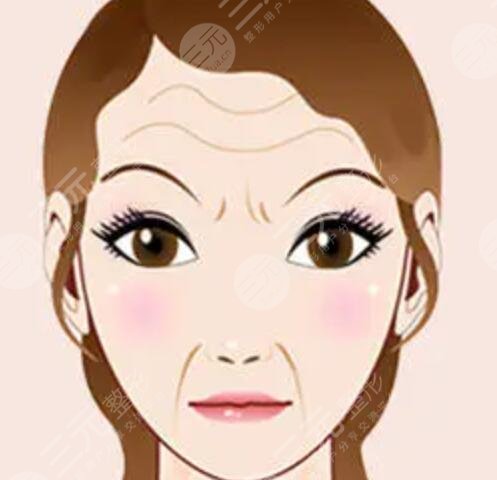 皮肤松弛下垂做了音波拉皮 果很惊艳