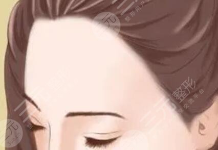 自体脂肪填充额头,咸鱼翻身是什么意思